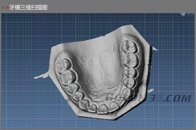 牙模三維掃描案例