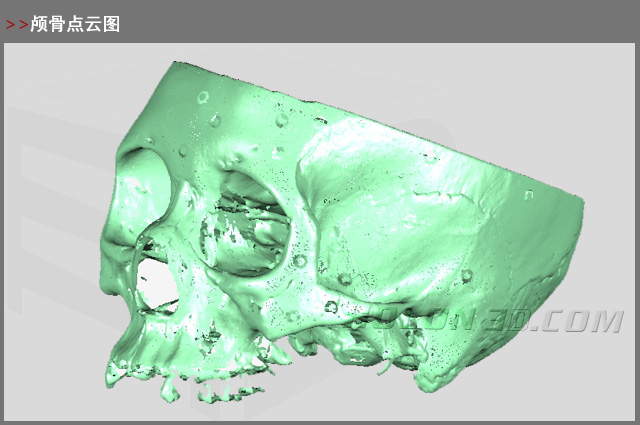 顱骨點云圖