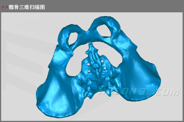 髖骨三維掃描圖