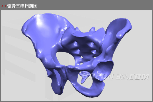 髖骨三維掃描圖