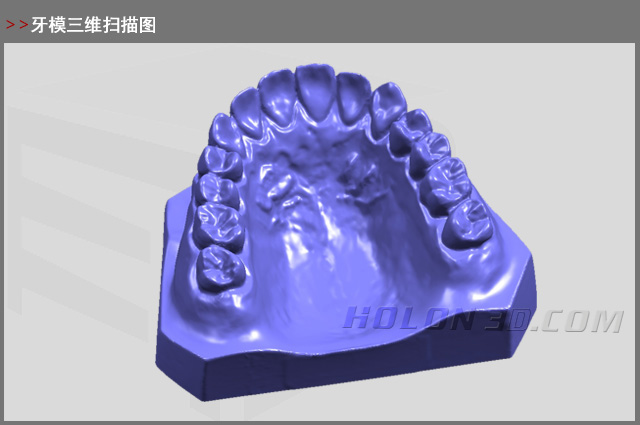 牙模三維掃描圖